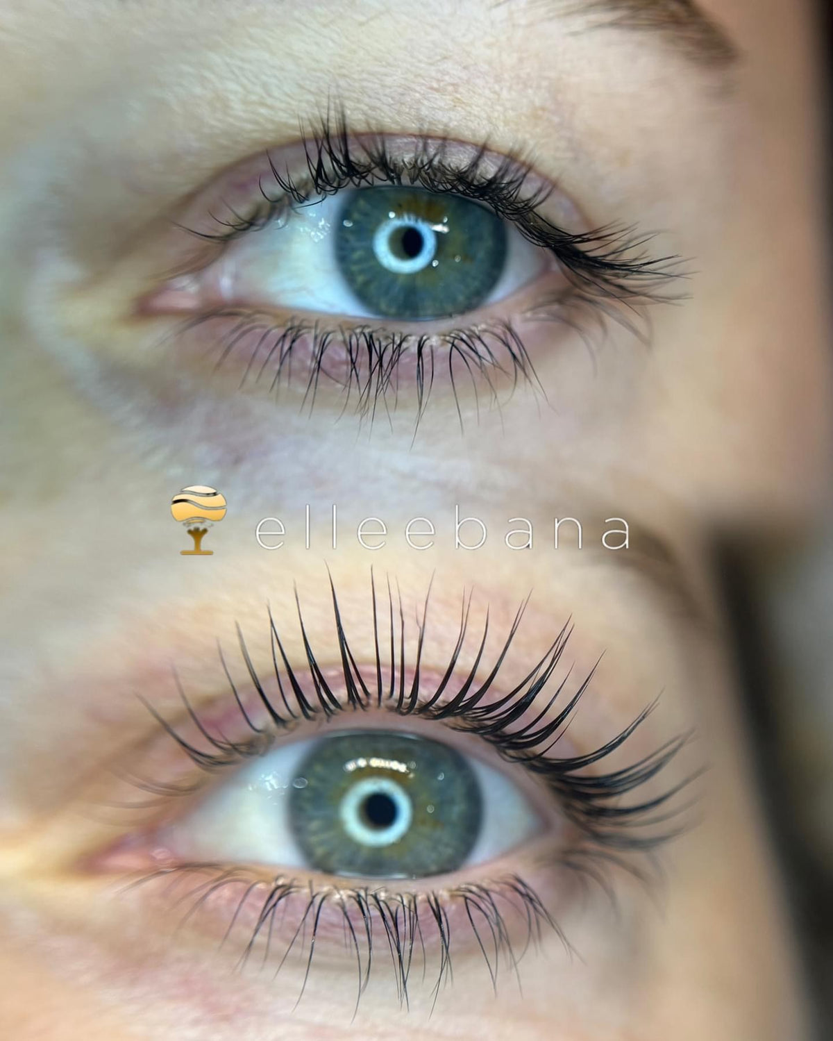 Eye Enhancements