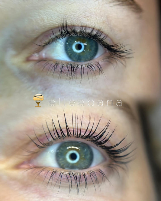 Eye Enhancements